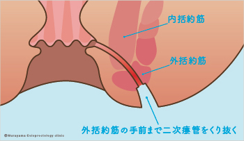 ①方法