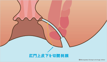 ③方法