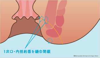 ④方法