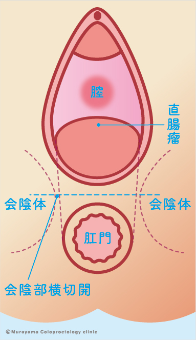 ①手術方法